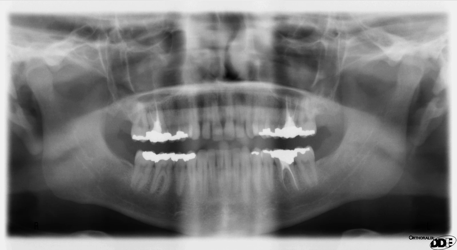 Example dental radiograph showing teeth, roots, and surrounding structures