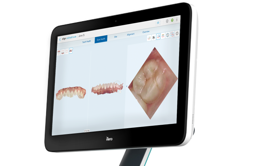 Manufacturer example of the Oral Health Suite gum health view